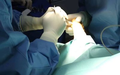 Leczenie haluksów – nie tylko operacja