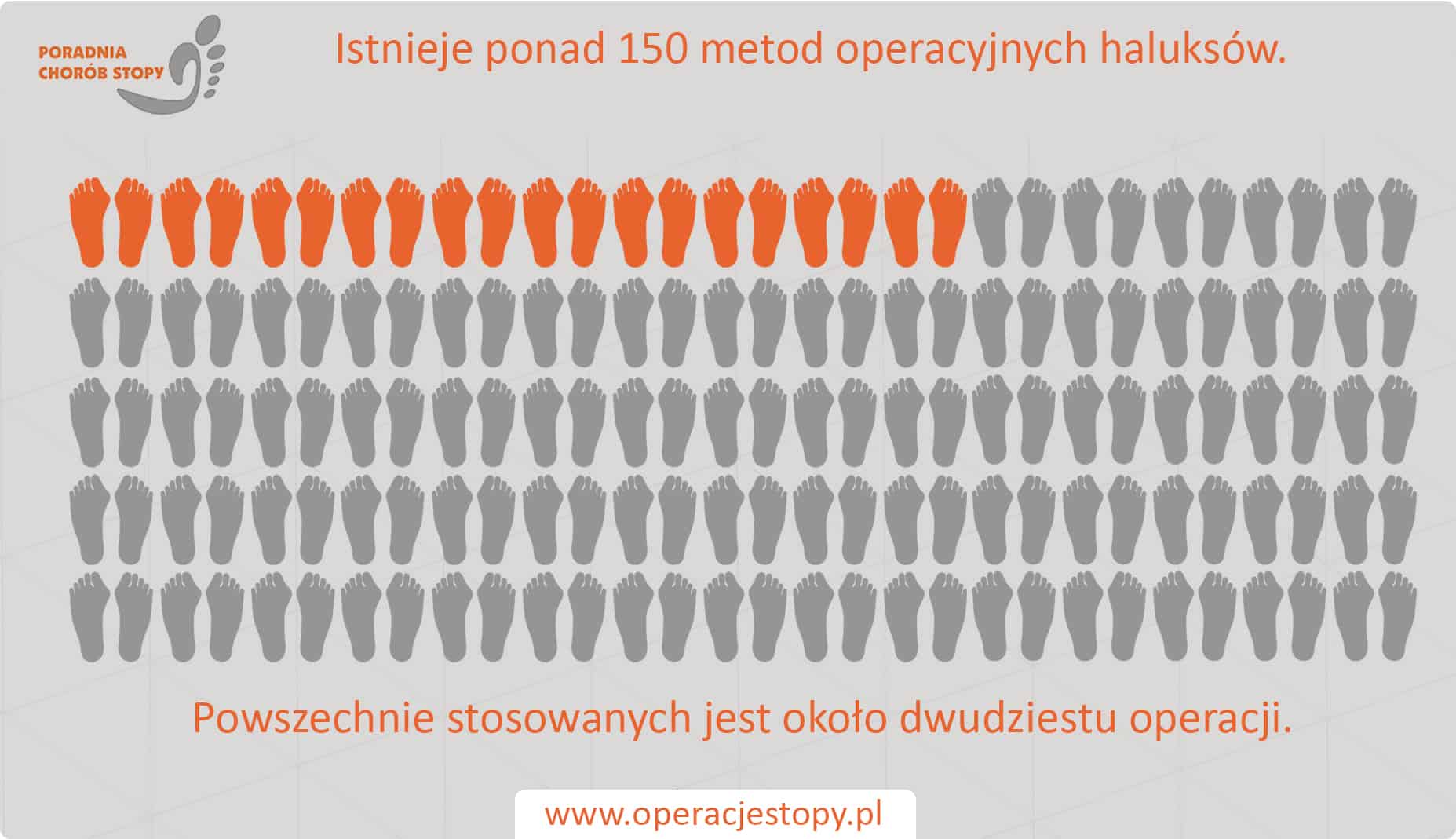 Operacjestopy.pl Haluksy - operacje