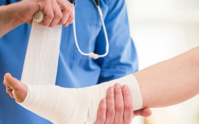 Jak dbać o stopę po operacji haluksa?